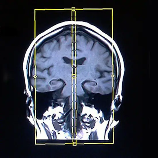MRI Brain Special Protocol